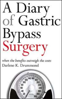   Life After Gastric Bypass 6 Steps To Ensure Your 