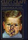   Rare Deformities by D. Ralph Millard, Lippincott Williams & Wilkins