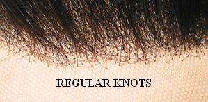   Knots? A lace wig knot is the tie that holds the hair to thecap