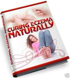 Cure Eczema Naturally skin baby cause remedy treatment  