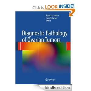 Diagnostic Pathology of Ovarian Tumors Robert A. Soslow, Carmen 